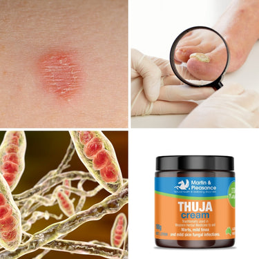 Martin & Pleasance Herbal Cream | Natural Thuja Cream